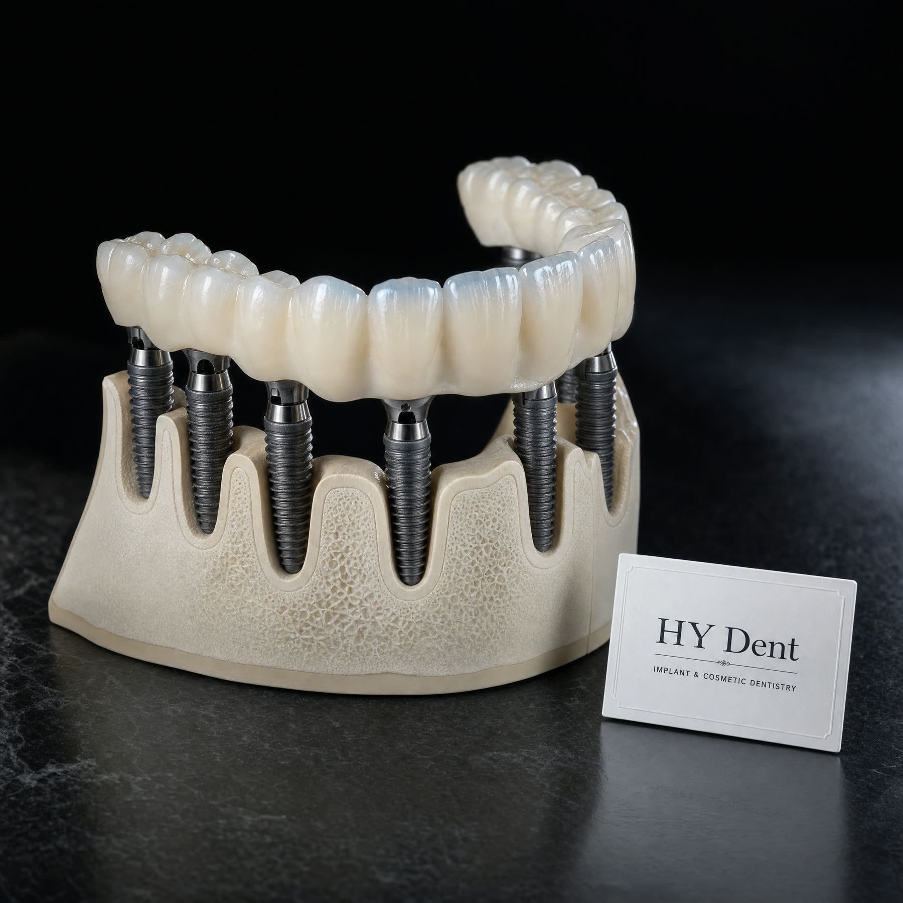 3on6 all-on-6 full-arch bridge system product shot with HY Dent clinic label