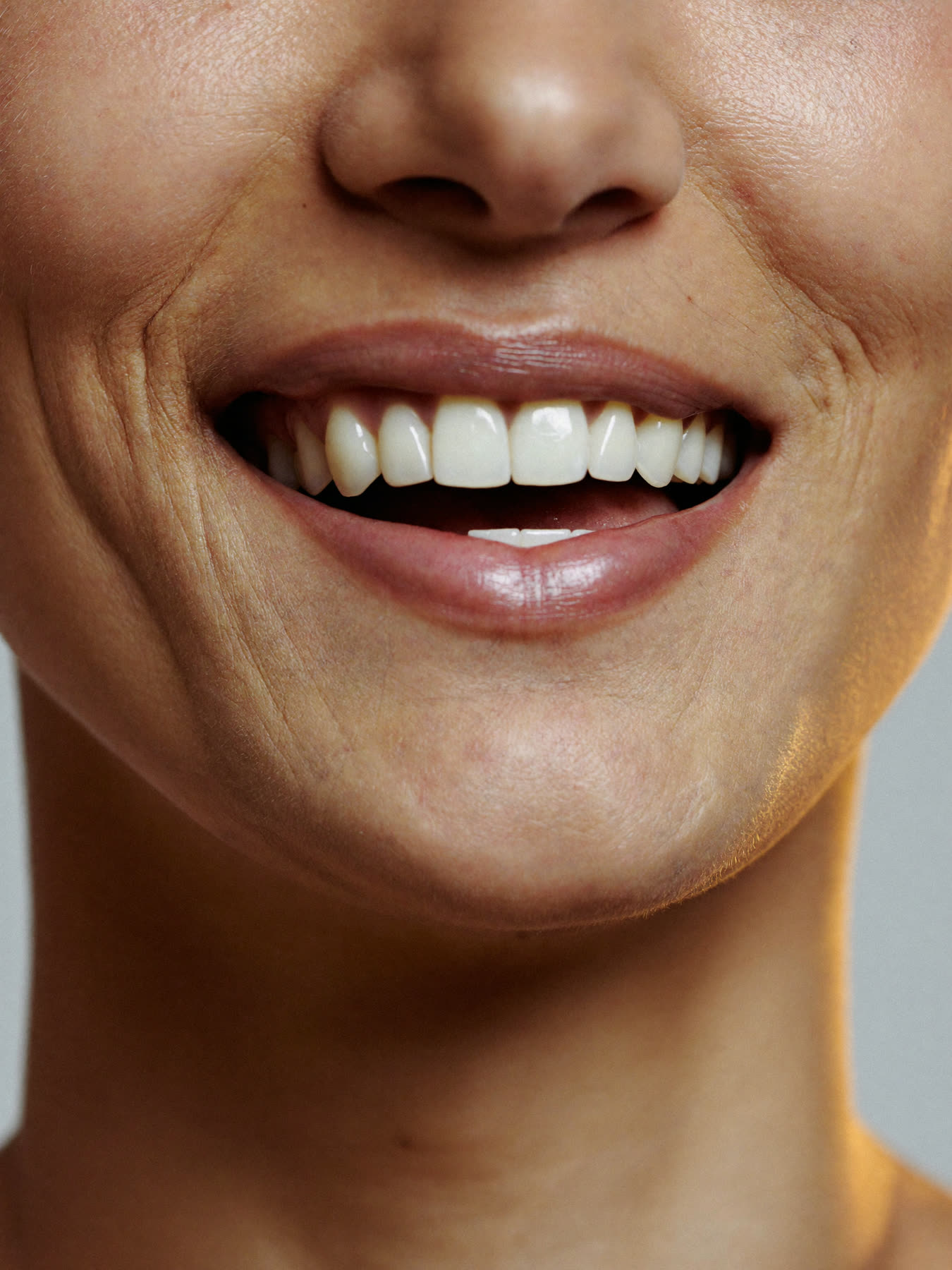 Close-up of a smile used to illustrate the digital smile design process