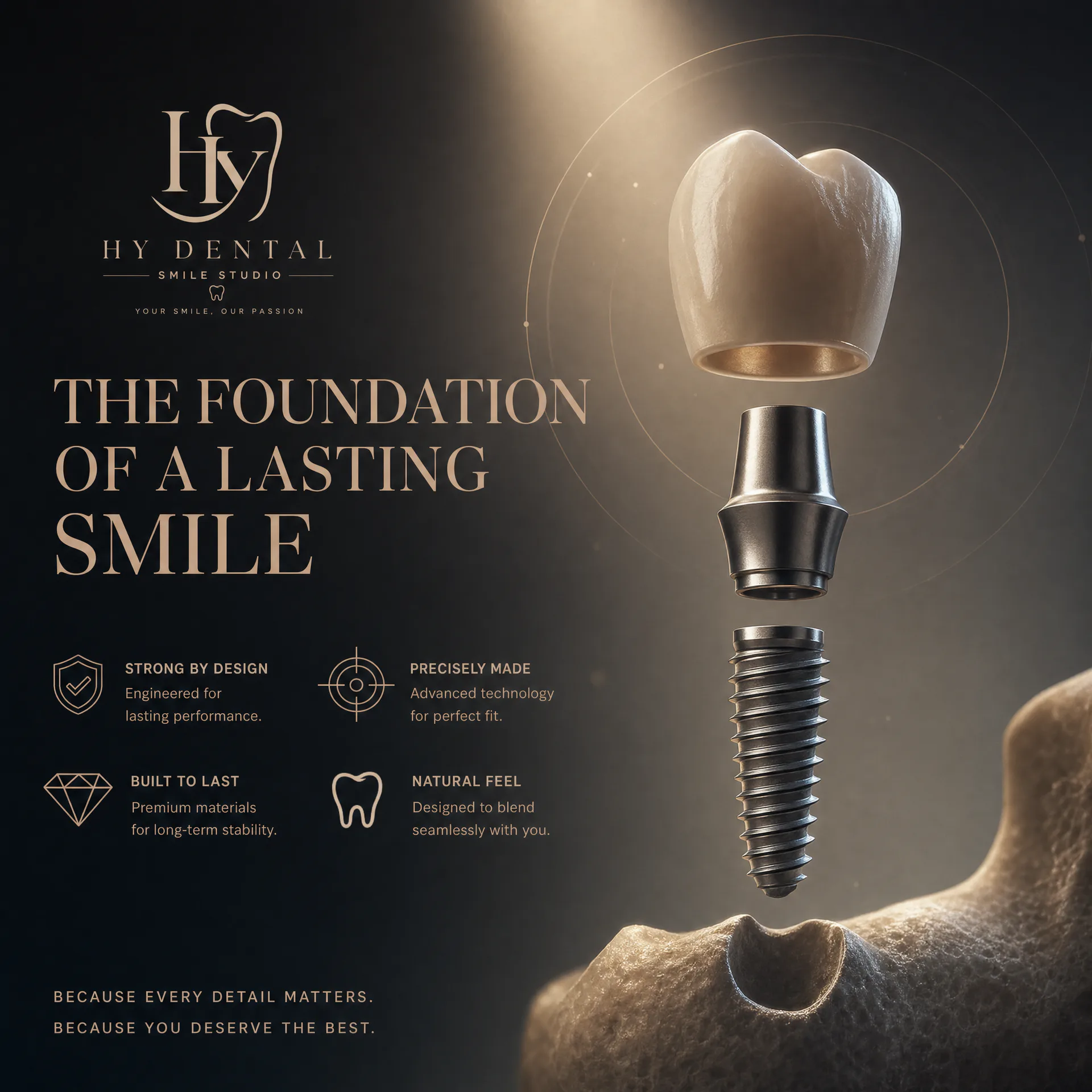 Dental implant and bone structure used to explain clinical suitability